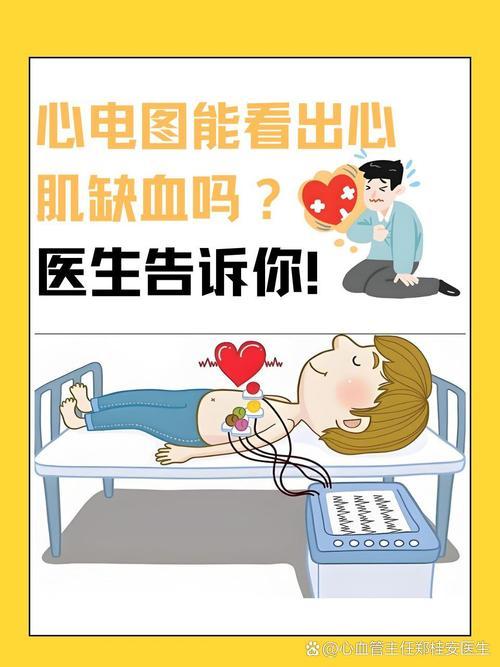 人到中年真是不敢大意，以前每次体检看到心电图正常就彻底放心了，看完这篇文章才惊出