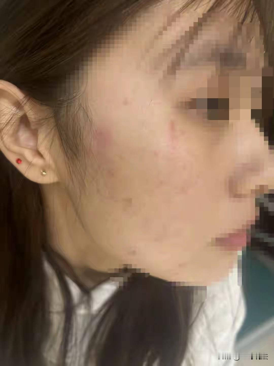 就不该开门! 山东东营，一18岁女子独自在家，听到有人敲门，开门后发现并不认识，