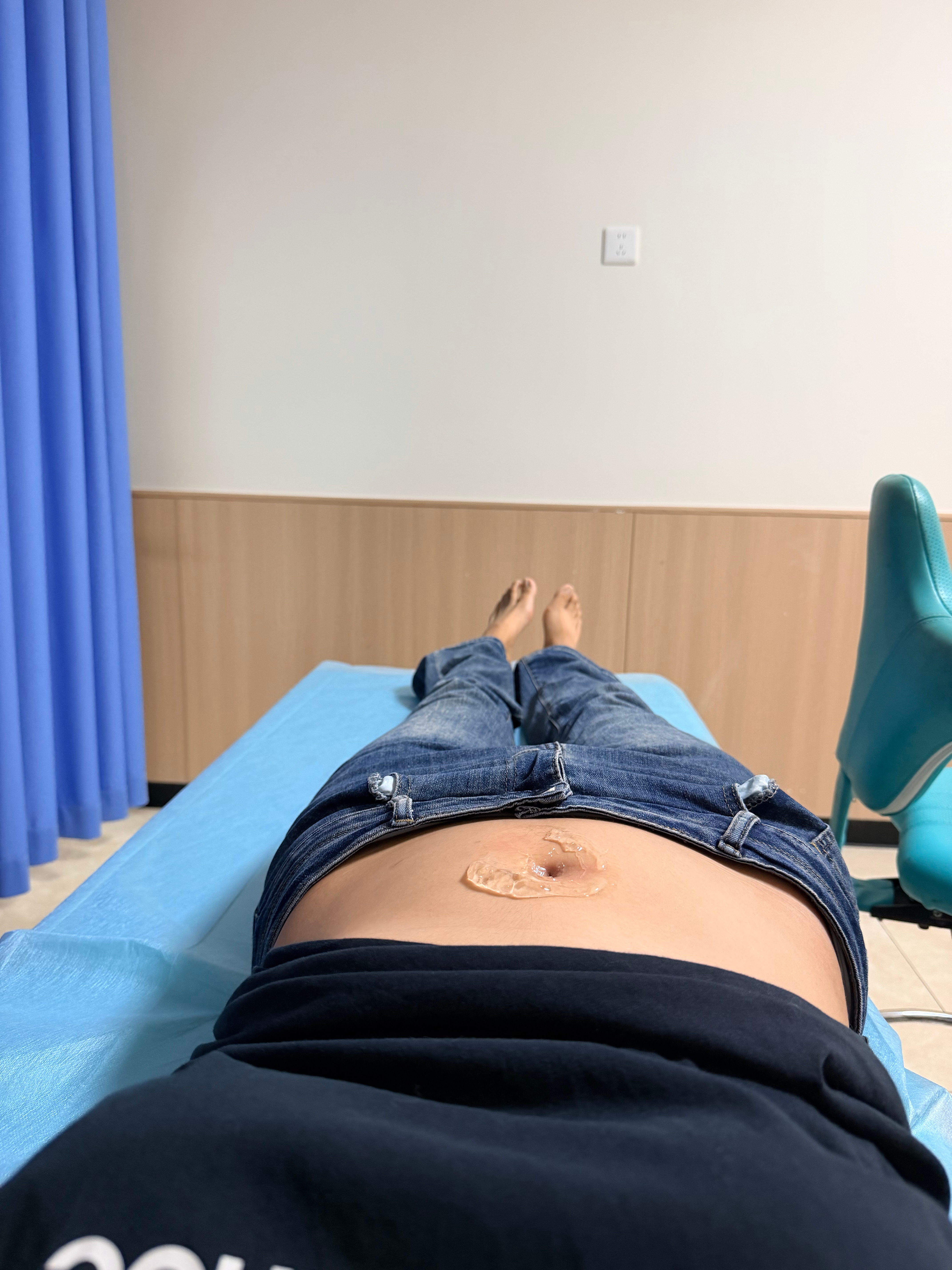 我真力竭了一个月做好几次b超肚脐求求了快点好吧我真不想把我的肚脐切开… ​​​