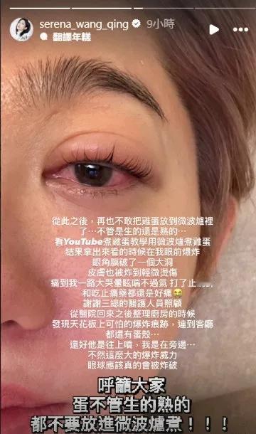 台湾女演员微波炉煮蛋被炸伤眼睛，说真的，看到这新闻我第一反应是：这蛋炸得够响不？