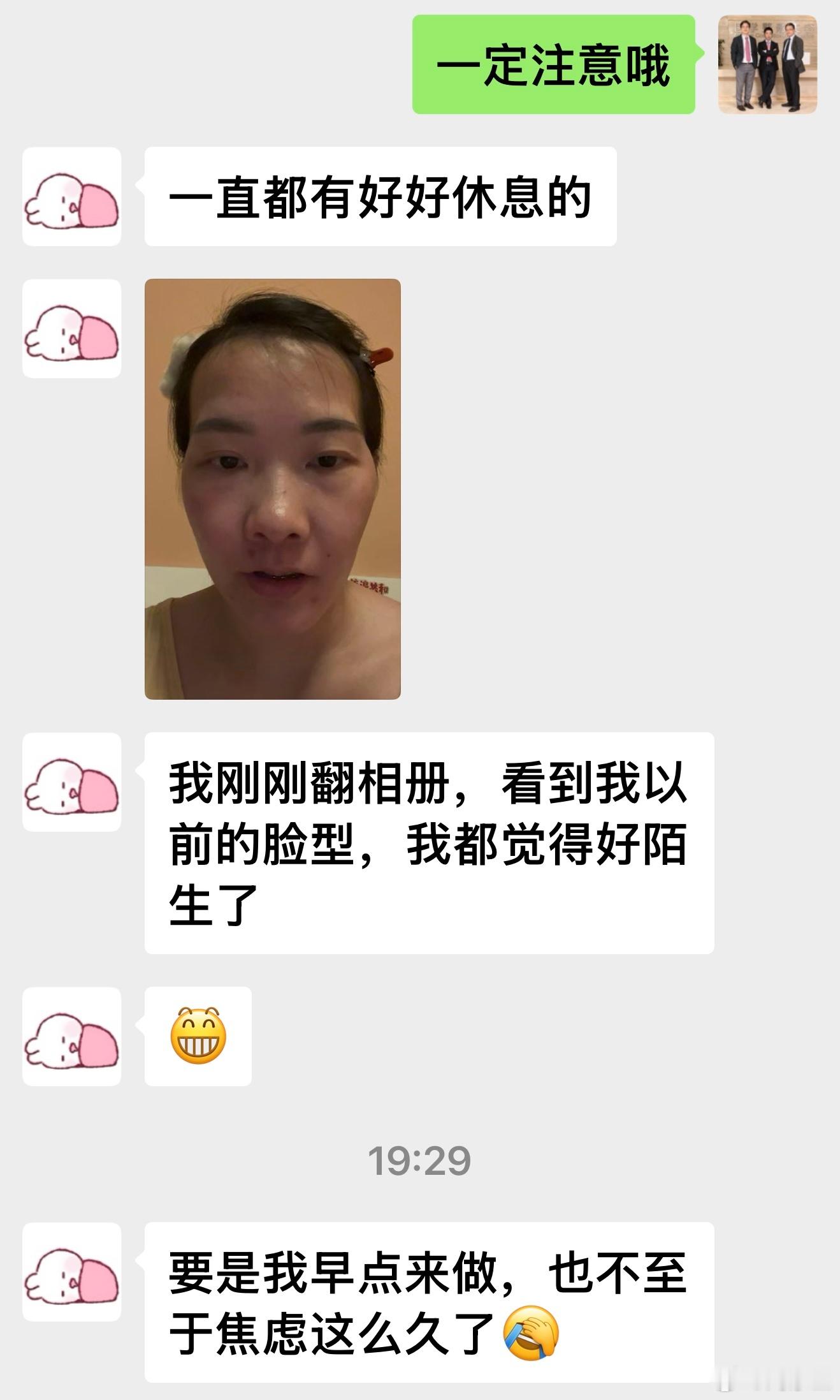 假体丰太阳穴，做完脸型跟之前都完全不一样了，看着显年轻很多！ 