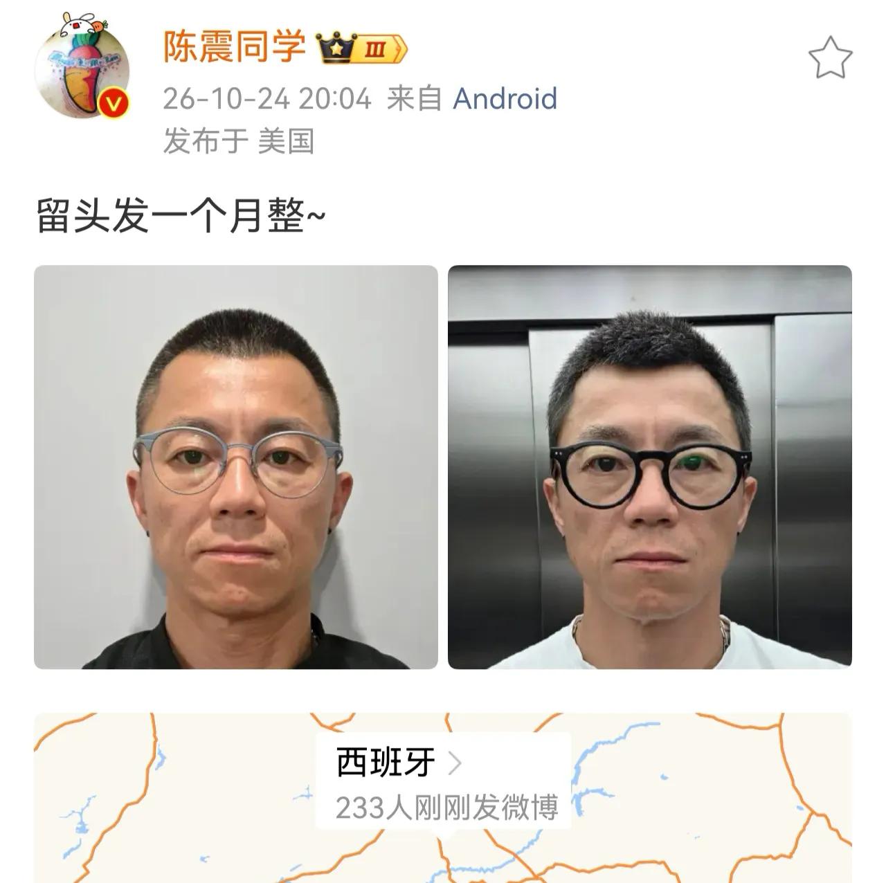 远在西班牙的陈震，再次向网友展示自己的蓄发进展，依旧是怼脸无美颜正面照，这也就是