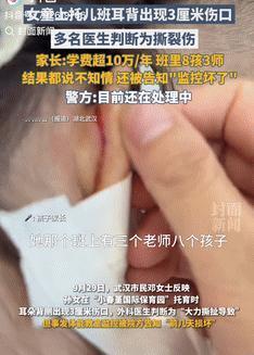必须追责！9月29日湖北武汉，一女孩上托儿班回家后，家长竟发现她耳后有道3厘米长