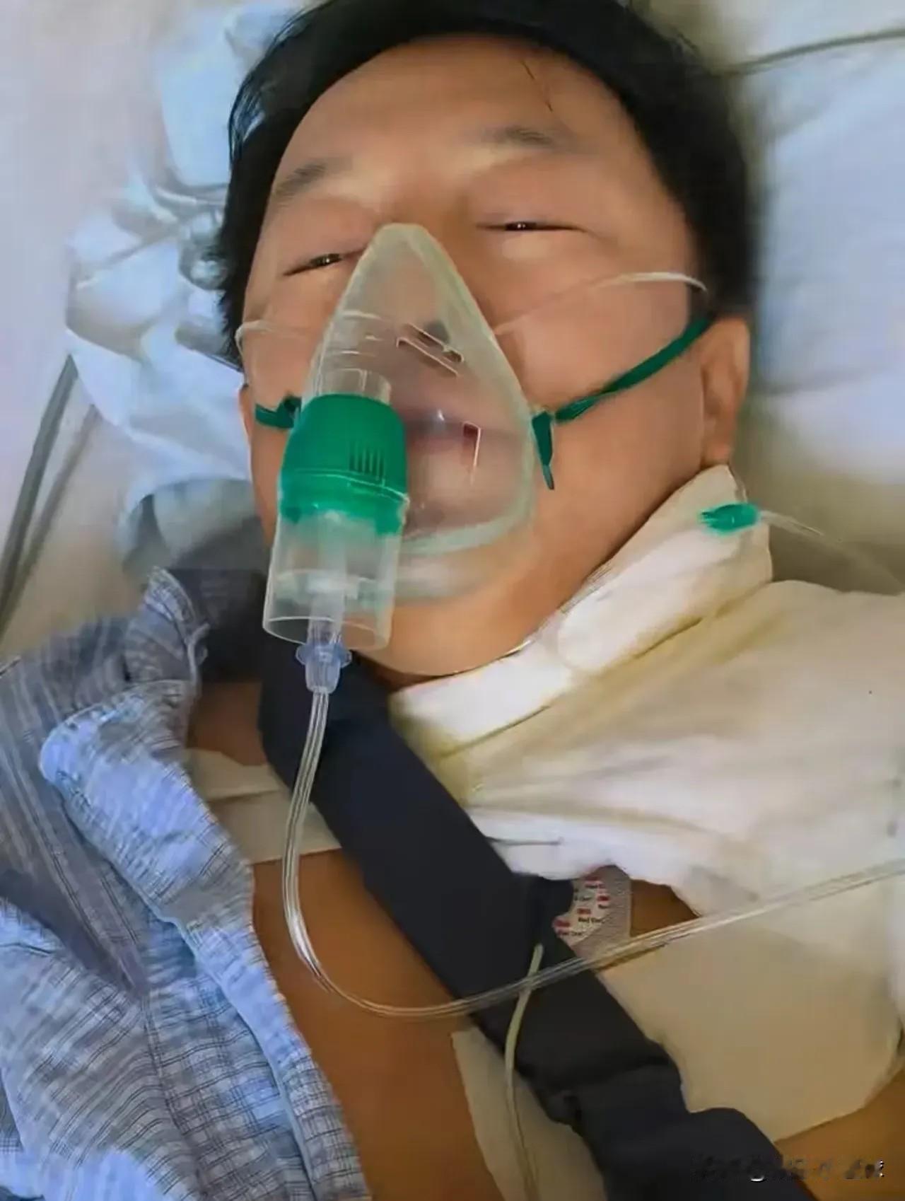 短短十几天，黄渤连续两次因骑自行车摔伤，这次连锁骨也骨折了。9月3日，他在自家门