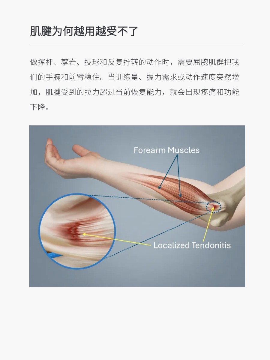 手肘内侧疼怎么办 拧瓶盖、提购物袋、挥杆、投掷，手肘内侧像被针扎一下，刚开始只是