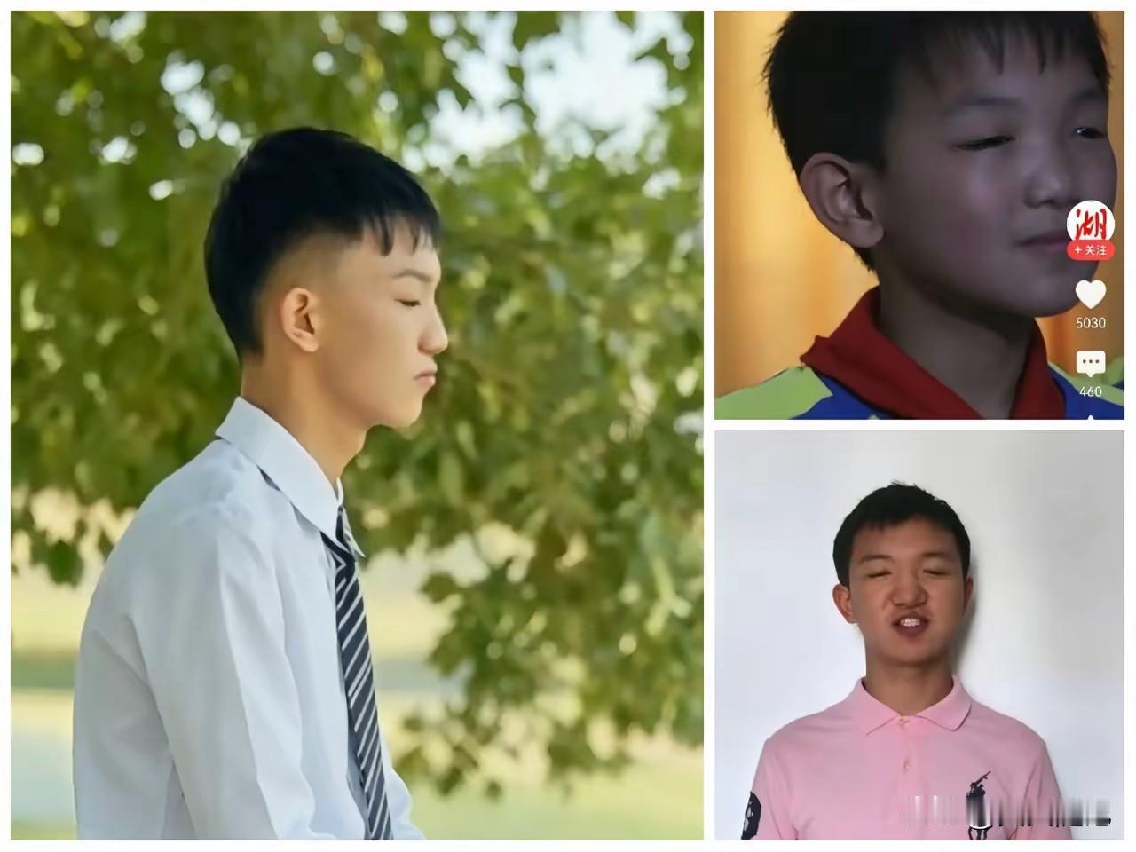挖眼受害者全国第一
你见过狠人吗
我见过。
一个几岁的小孩。
被人活生生挖掉了双