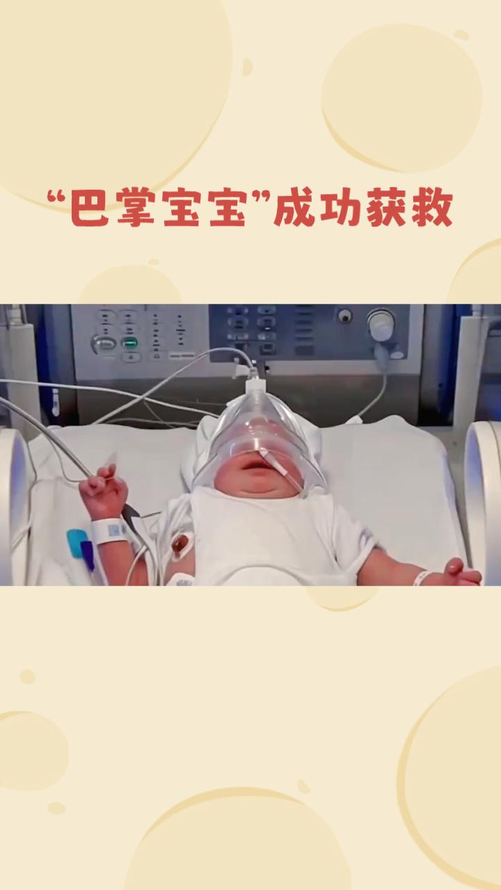 巴掌大的婴儿，如何挑战生命极限？
近日，医学界再次见证了生命的奇迹。一名胎龄仅2
