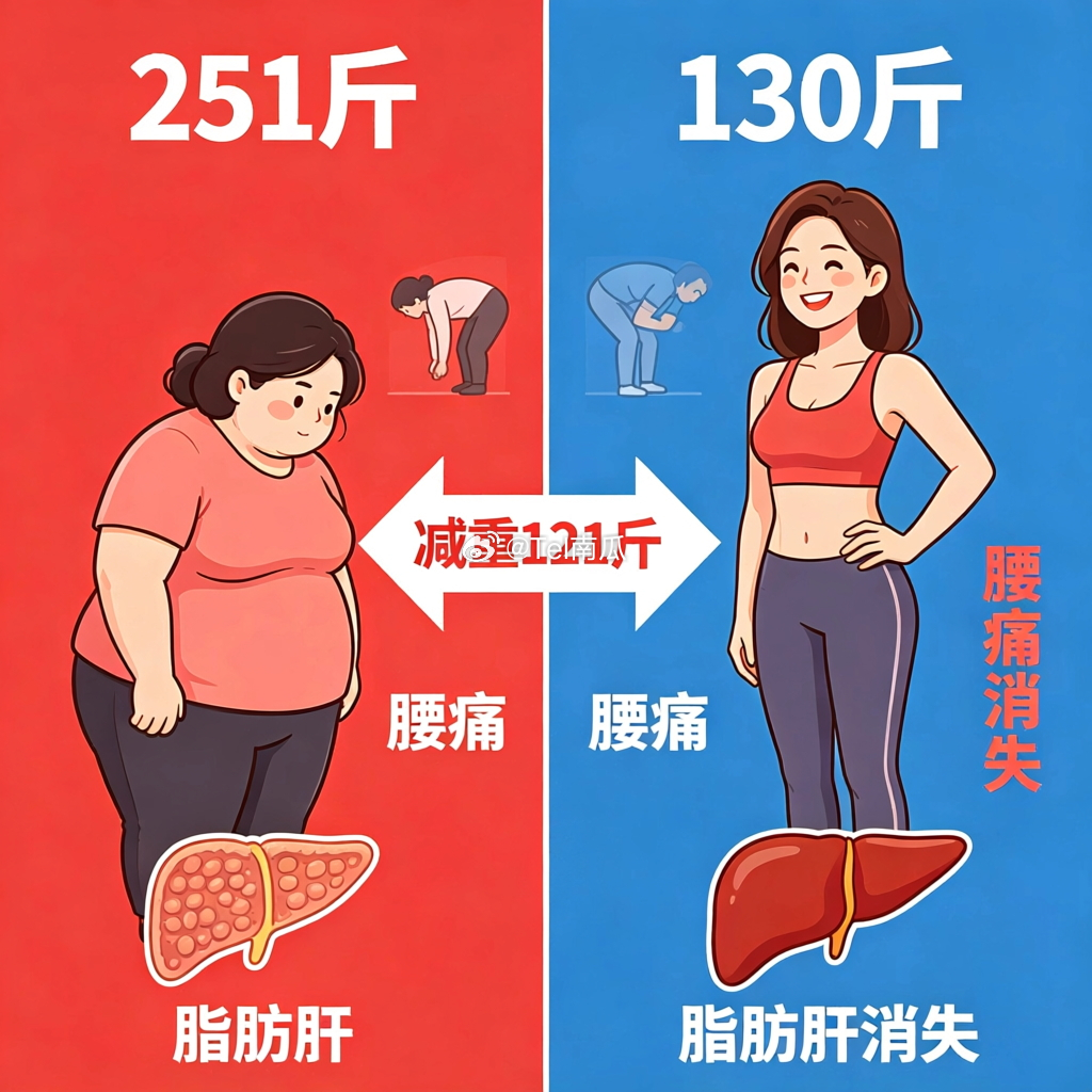 251斤女生减重121斤判若两人四川的王女士从小体型就偏胖，18岁体重就到了20