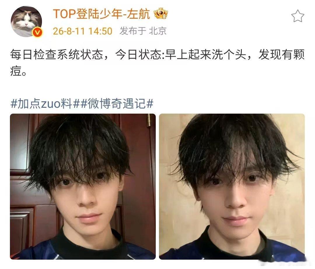 左航长痘了左航嘴角长了痘左航今天长痘了 