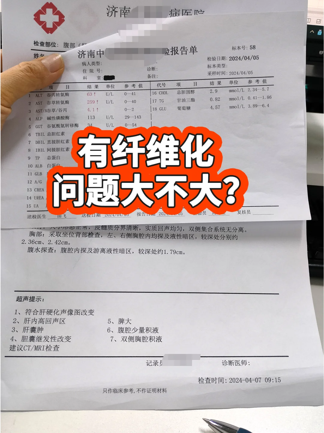 有肝纤维化，问题大不大，肝病朋友要知道！