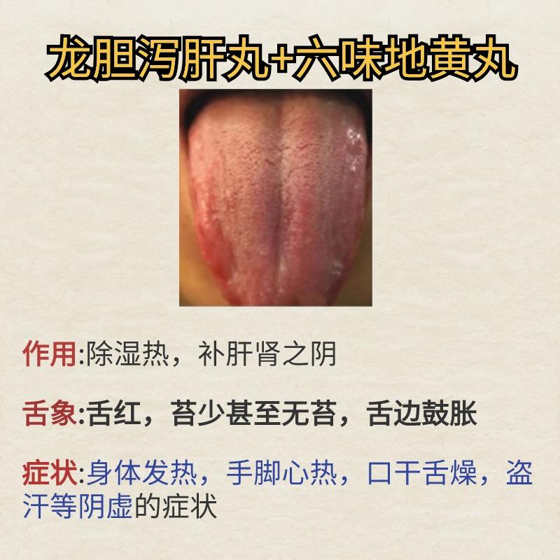 龙胆泻肝丸搭配，不仅清脾胃湿热，还可以除肝肾湿热。