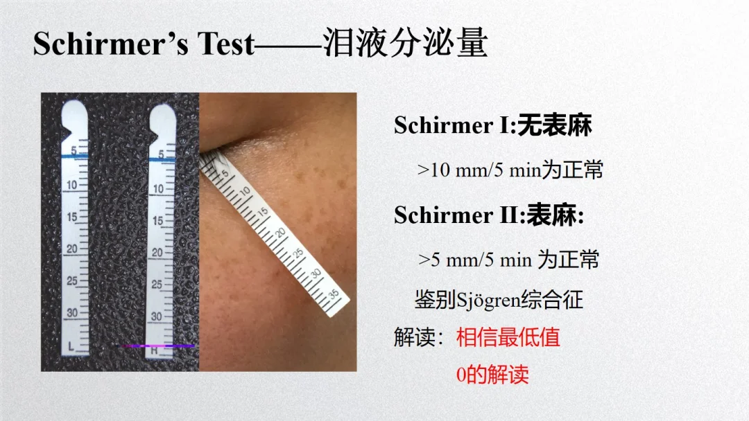 干眼检查，泪液分泌多少是正常的？