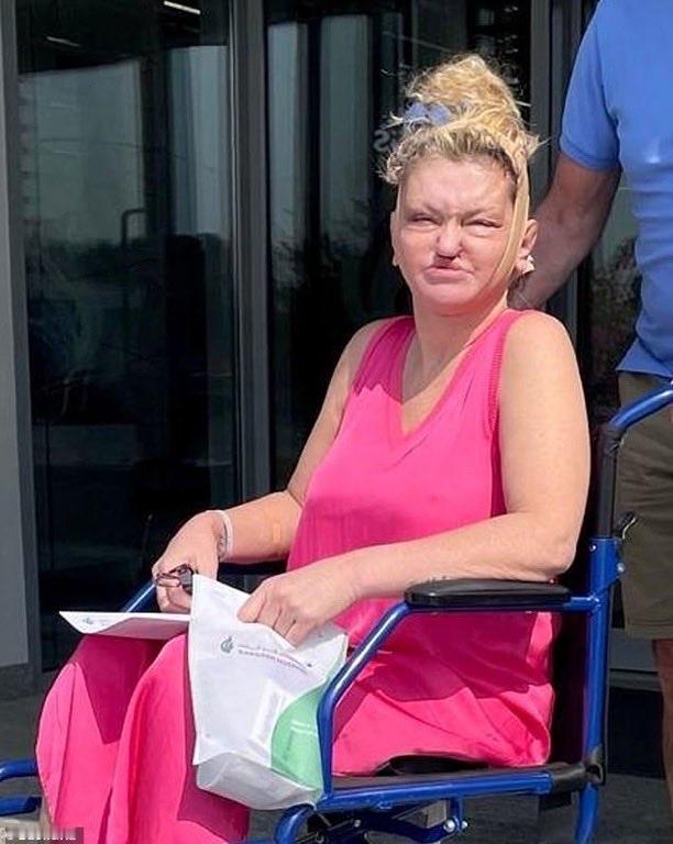 Danniella Westbrook 最近前往迪拜进行整容手术，脸在大手术后重