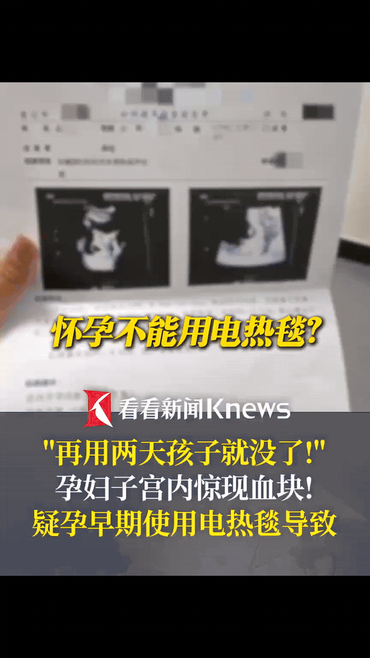 “太可怕了！”近日，北京，一女子因为天气变冷，便在床上铺了电热毯取暖，谁知没过几