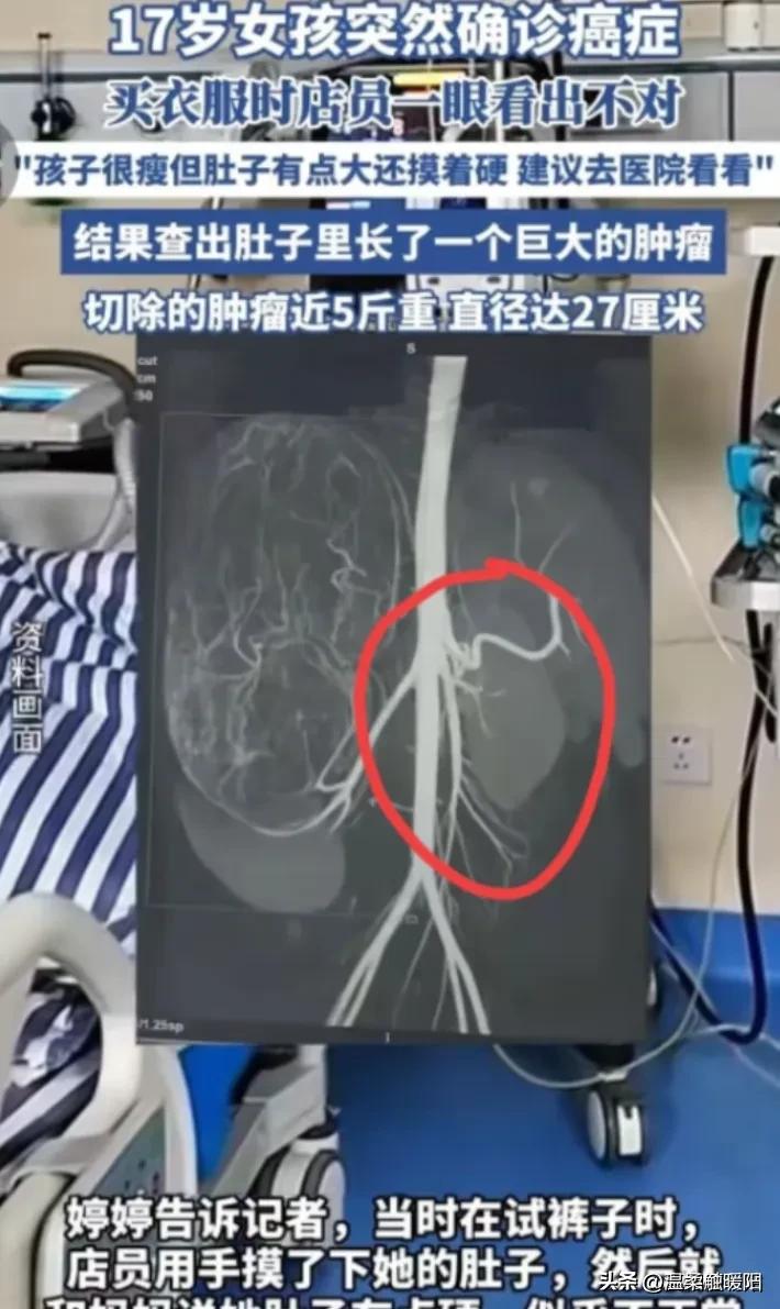 2025年6月，广东17岁女孩和妈妈一起逛街买衣服，在试裤子的时候，老板娘发觉女