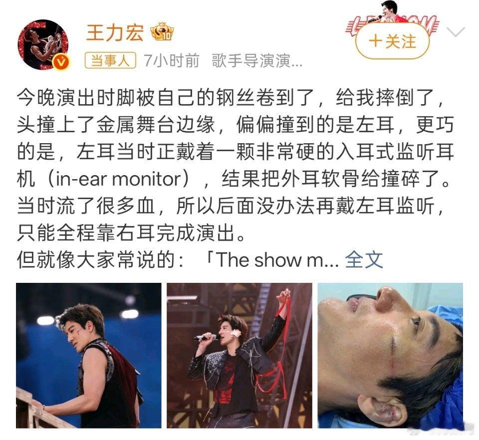 王力宏缝了39针昨天看消息说王力宏在舞台上摔倒了，然后站起来坚持把演出完成，太敬