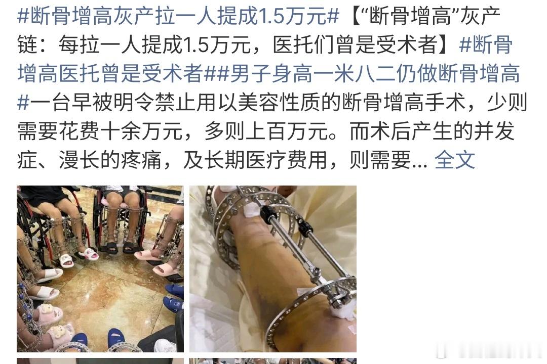 断骨增高灰产拉一人提成1.5万元断骨增高灰产一人提成1.5万元，万万没想到，这种