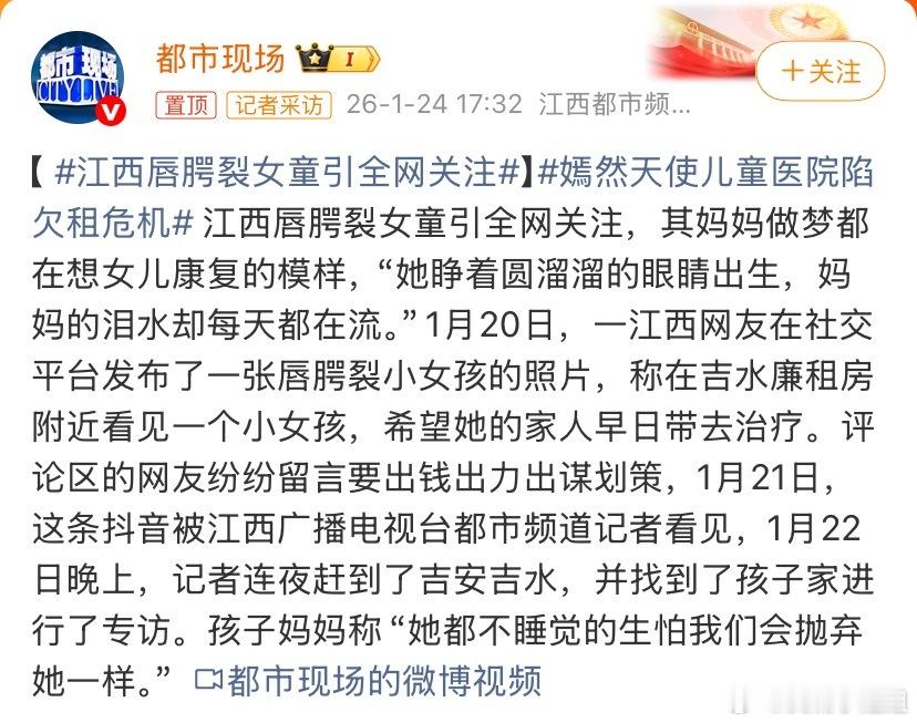 江西唇腭裂女童引全网关注我记得第一次看到这个病症还是因为李亚鹏，特别是很多小孩子