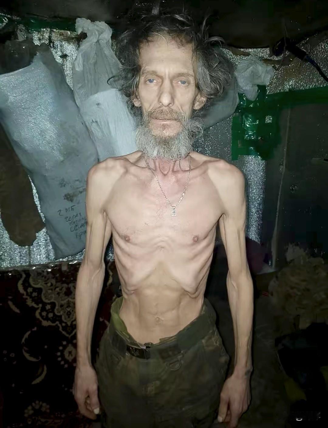 实拍画面曝光！乌军前线士兵饿到皮包骨头，补给彻底断裂
 
近期顿巴斯前线实拍画面