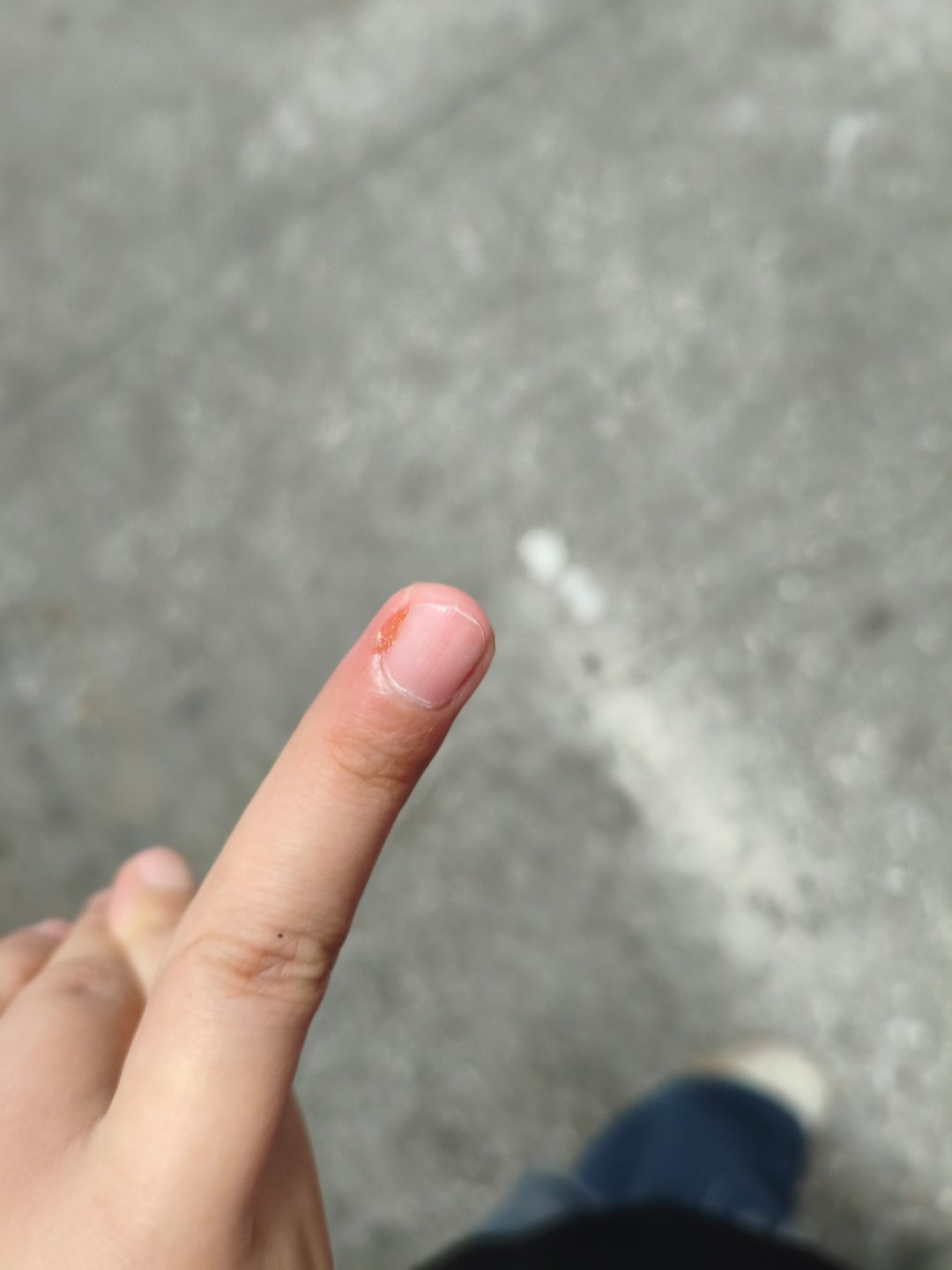 上班上着，把手干废了[可爱] ​​​