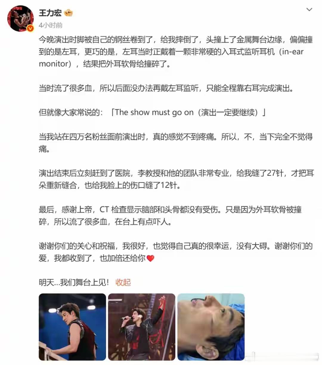 缝了39针！王力宏演唱会伤情曝光：外耳软骨被撞碎。 