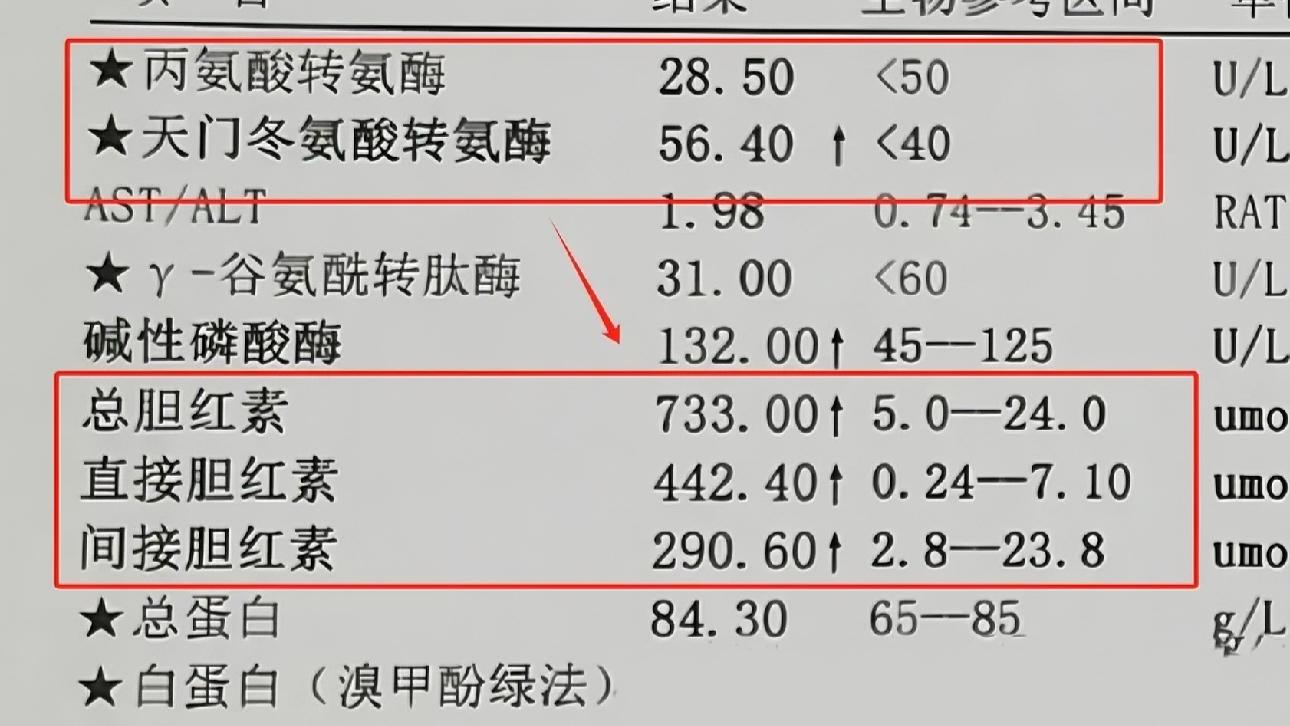 肝功能检查中，这2项指标相差越大，肝越差。大家好，我是李晓沛，接诊的肝...