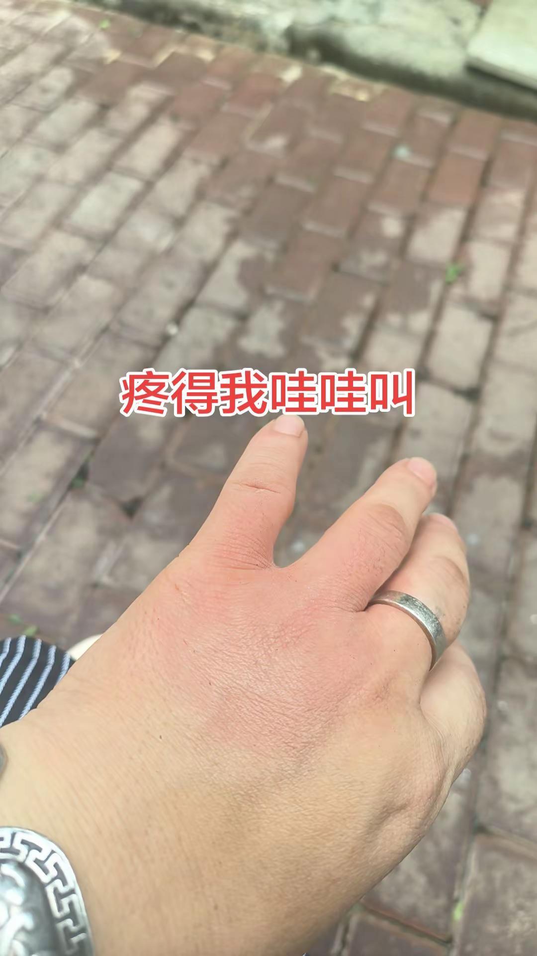 苦命是生来的 受伤是自己作的