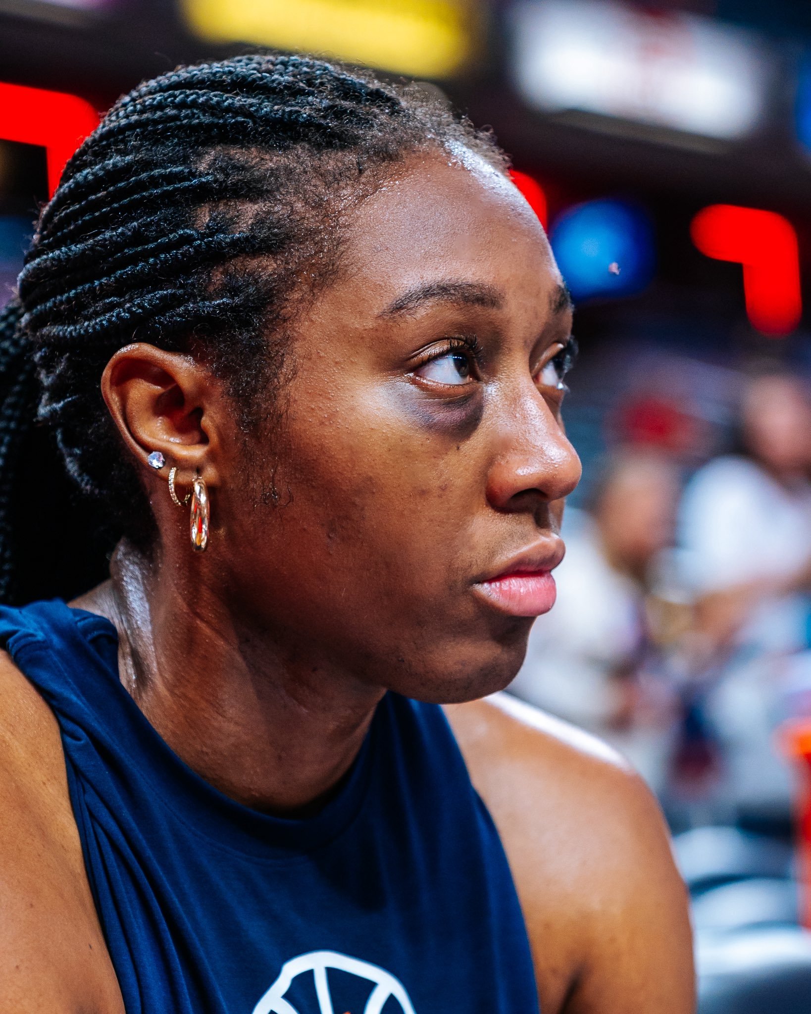 上一场抢篮板时被里斯肘部击中面部的波士顿 今天带着黑眼圈……WNBA2026印第