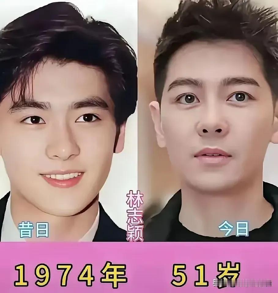 昔日男神今昔对比：有人活成冻龄神话，有人坦然老去，有人像换了个人。

先说林志颖