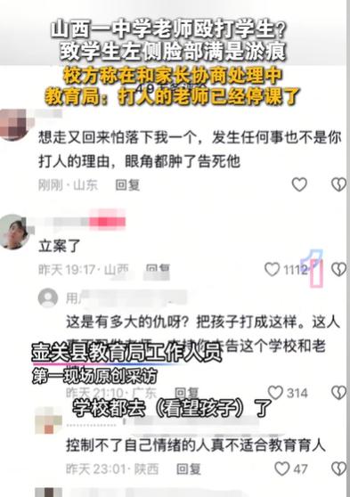 山西长治，家长看到自己的孩子，竟然被老师打，左脸全是淤痕，左眼角都有了淤血，他很