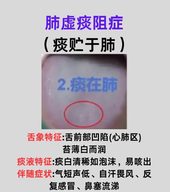 肺脾肾生痰舌象，辨证调理思路