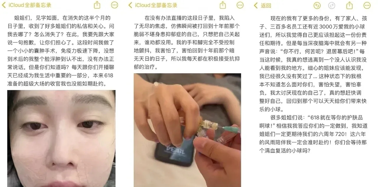 赵本山女儿抑郁症复发，经历囊肿手术后免疫力下降，脸部浮肿并出现抑郁症状。目前正积