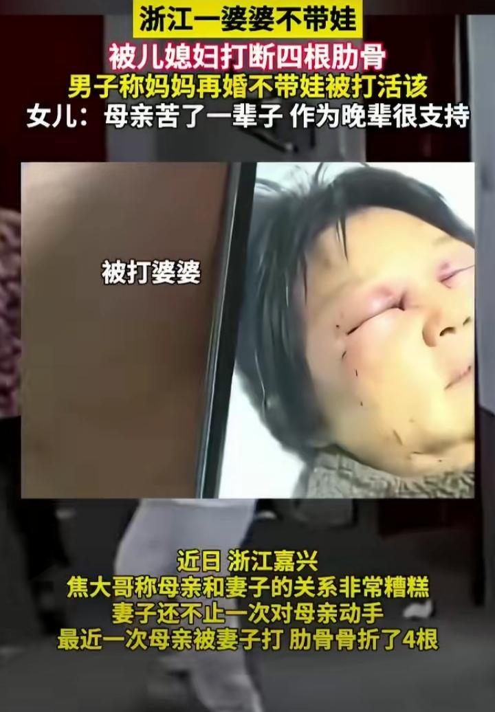 母亲被儿媳打断四根肋骨躺进医院，儿子竟然说“母亲有错在先，被打活该”。
“被打活