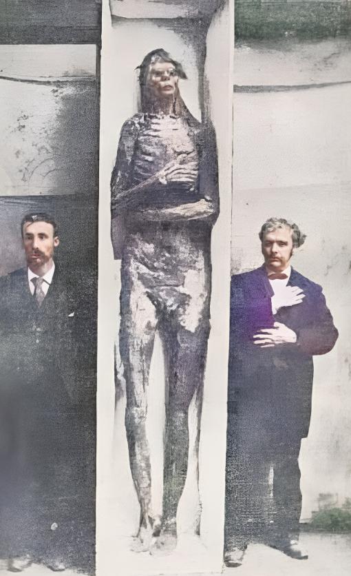 1895年一名探矿者在加利福尼亚发现了一具巨人的尸体。通过测量这具尸体，得知其体