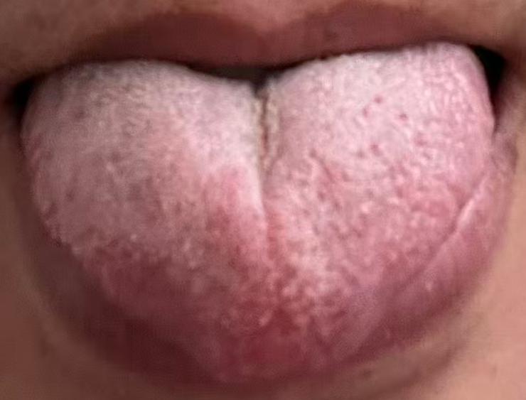 体虚问题切勿盲目进补，气血湿瘀同步调理，筑牢身体机能






很多男同胞一遇