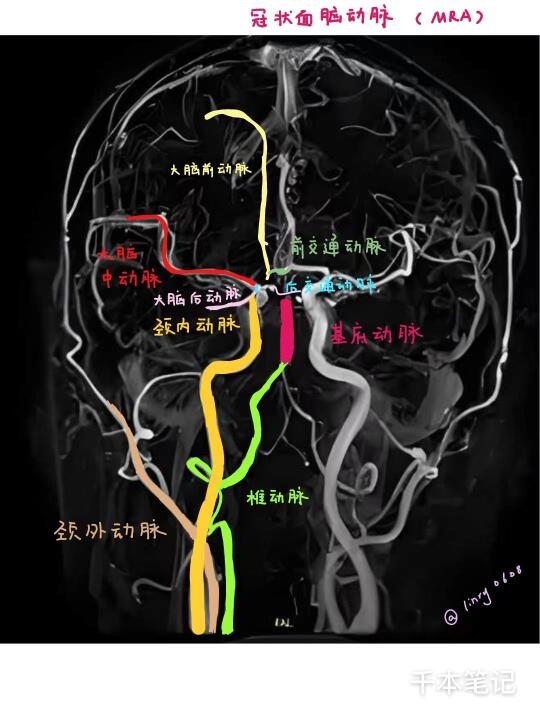 医学生绘本🎨第90弹【颅脑MRA】