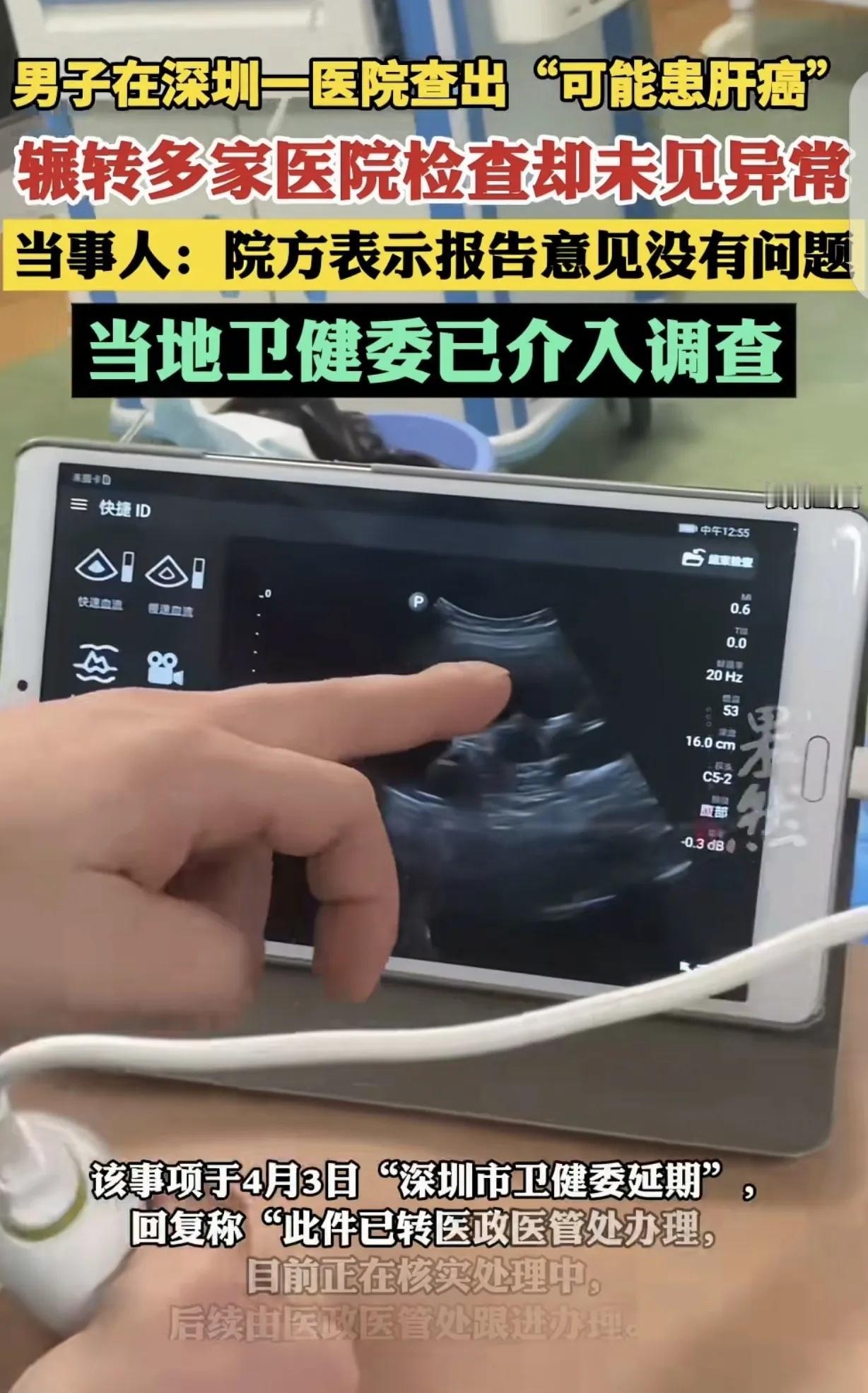 “真荒唐！”广东深圳一男子在医院查出“可能患肝癌”，可把他吓坏了，觉得天都塌了，