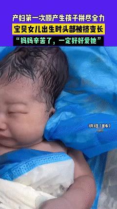 宝妈顺产一女儿，头部异常长还顶着大包，助产师：正常现象。

近日，湖南一宝妈顺产