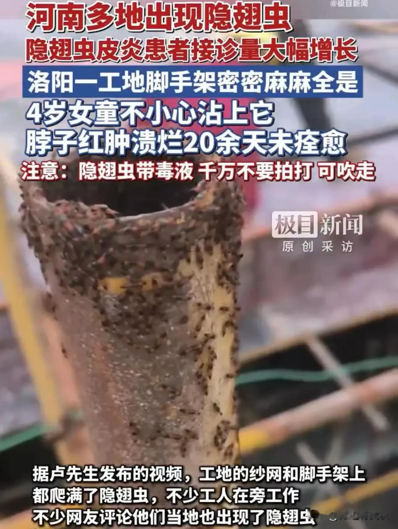 3. 河南多地现隐翅虫伤人事件：近日，河南多地出现隐翅虫，被称为“飞行的硫酸”。