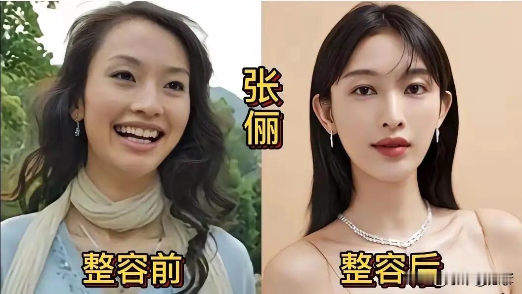 每个人对自己的颜值都会有很高的要求都想着去变美，但是有些微整之后确实挺成功的，不
