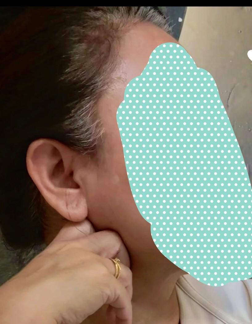 长白发很正常，医生说成因很多，因人而异。有杂白，有全白。这个白很均匀，长长了很美