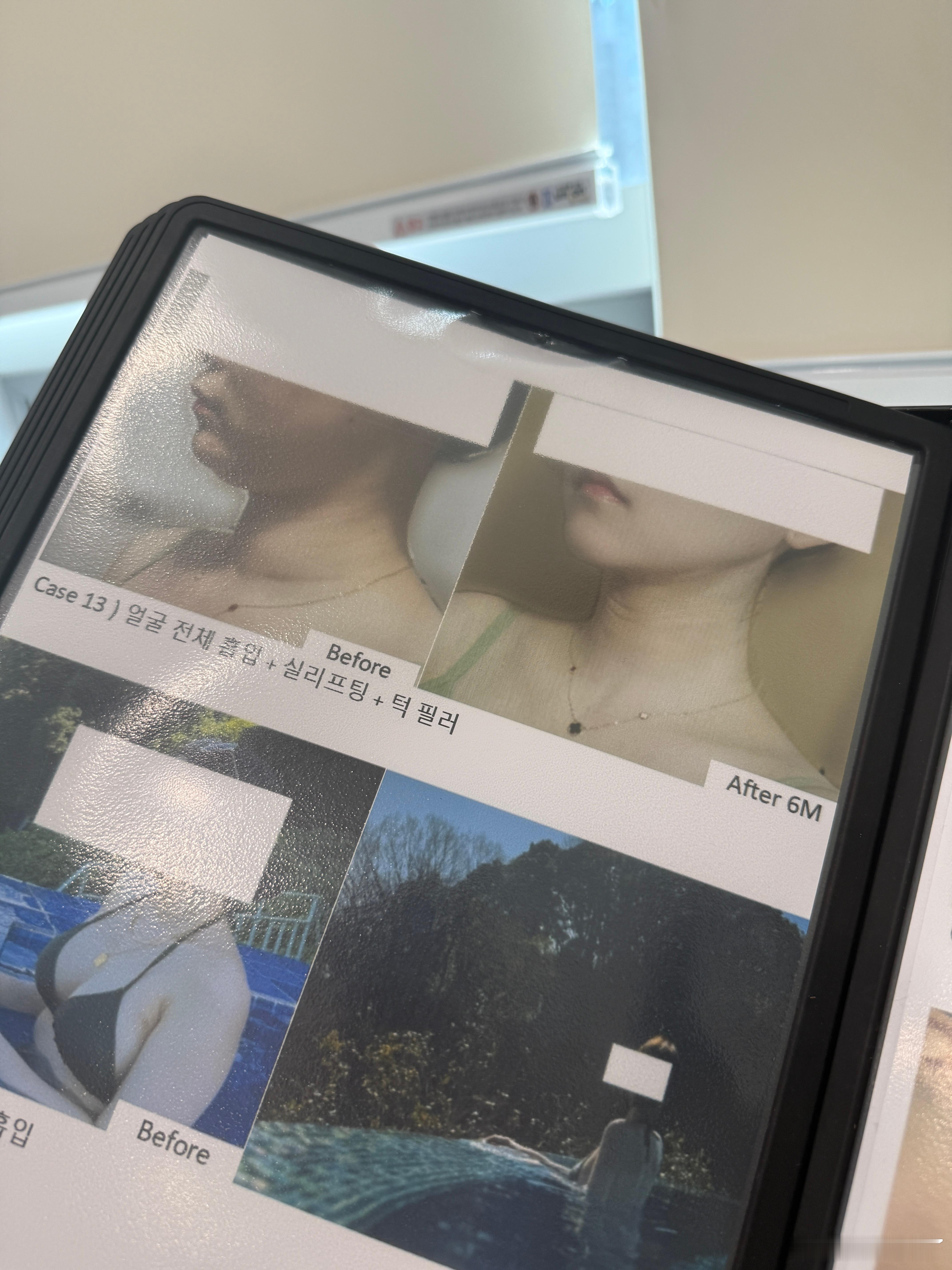 我觉得江南多的是那种你们搜不到找不到的本地人医院，这种本土程度甚至都不上babi