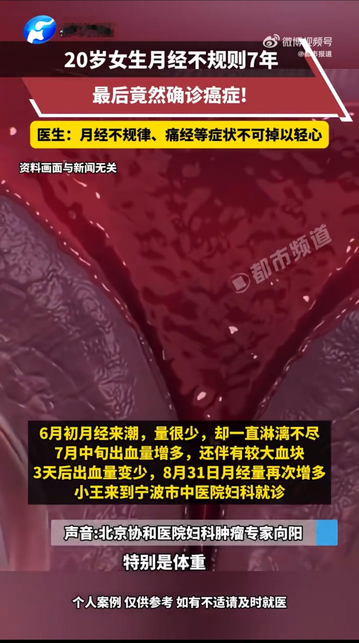 20岁女大学生从13岁开始就月经紊乱，经常两三个月不来，一来就是半个月。全家人都