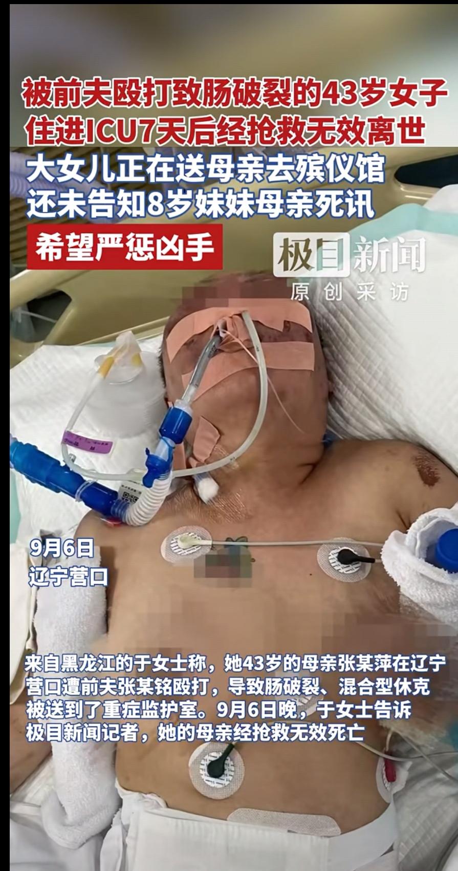 被前夫殴打至重伤女子，还是不幸离世。太残忍了！