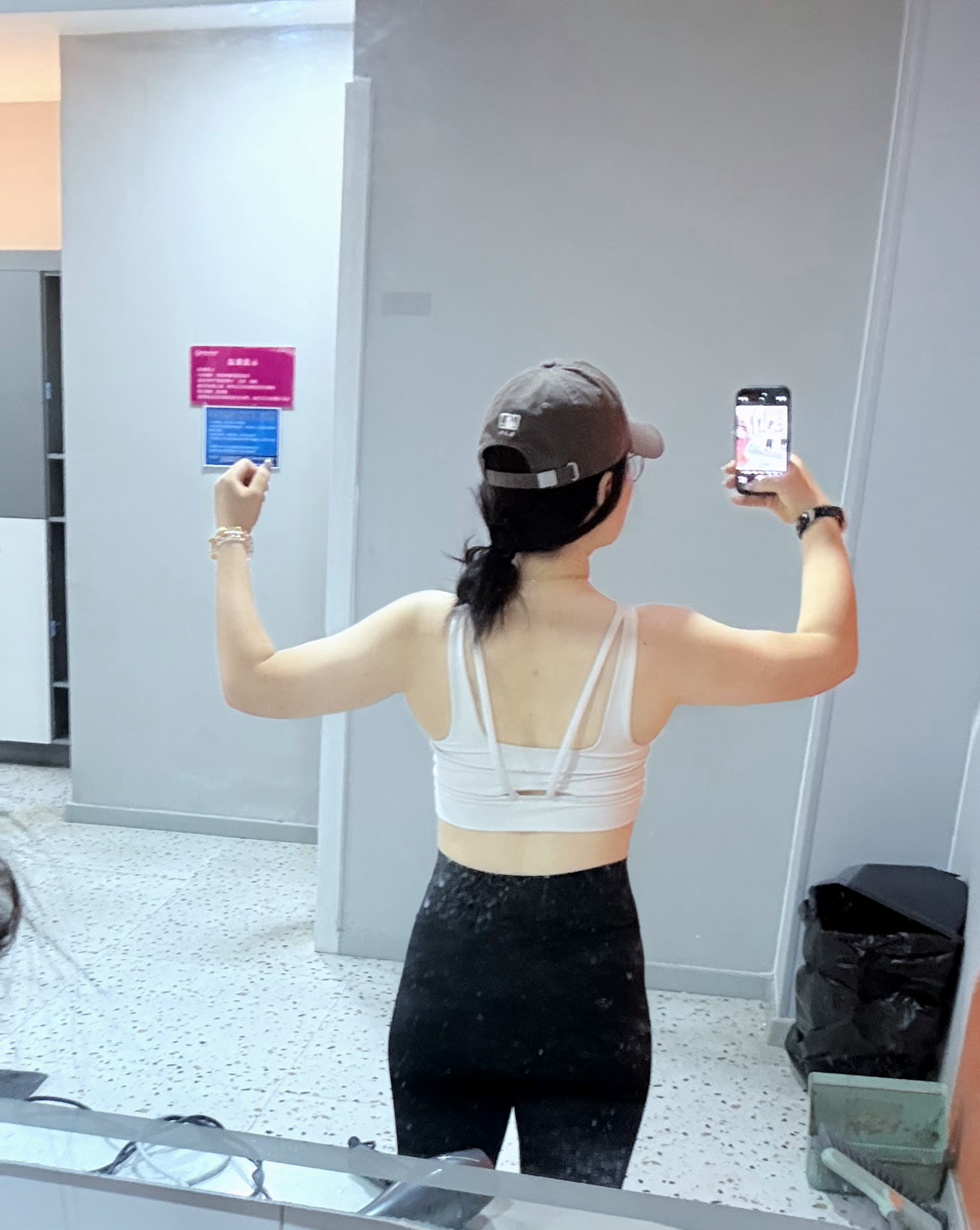 除了吸脂还有什么办法能治我的胳膊吗