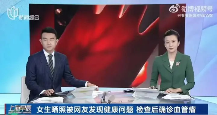 女生晒照被网友提醒有“瘤”？真的救命了！医生回应……