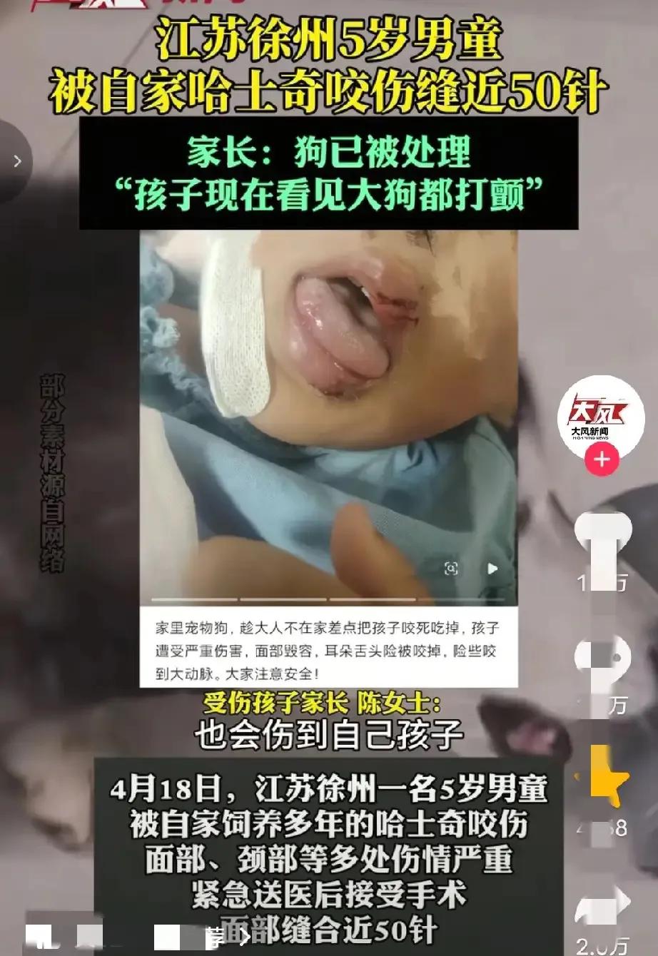 悲剧还是发生了！江苏徐州陈女士养了一只温顺的哈士奇，4.18日她5岁的儿子和狗狗