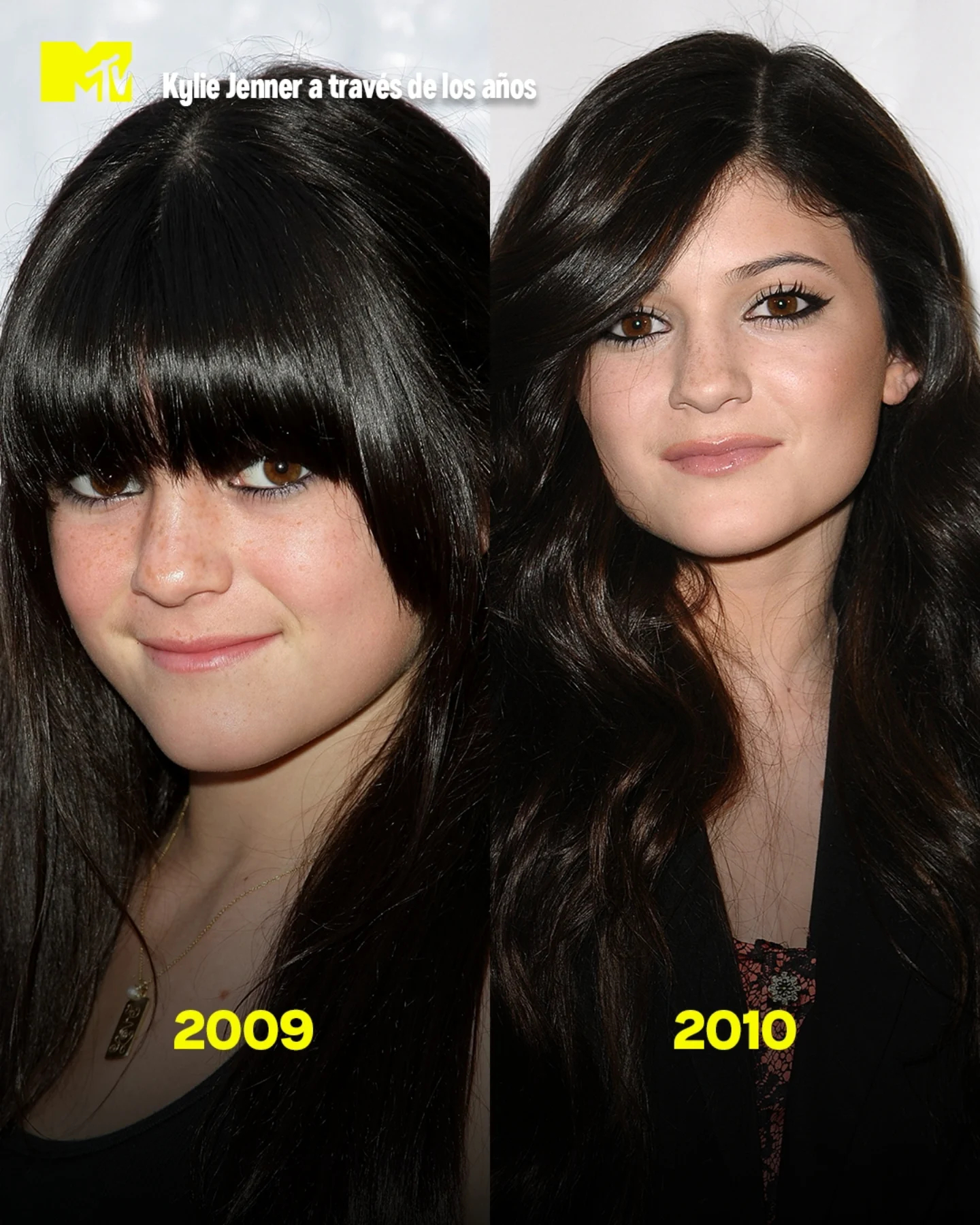 凯莉-詹纳2008年至今的外貌变化！自然发育、妆造风格还有医美，夸张点说人种都变