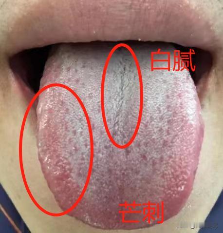 都说了，节制，节制，再节制，就是不听，看看自己的肾还能不能补回来了

一个28岁
