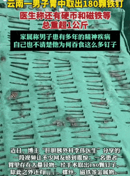 解释不清了！云南，一男子腹部剧痛送医，医生检查后当场被吓退三分：他体内居然塞满了